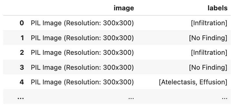 The Dataset. alkzar90/NIH-Chest-X-ray-dataset
