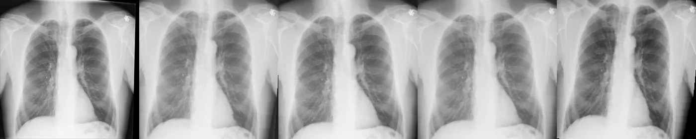 Original image (very left) + 4 augmentations.
