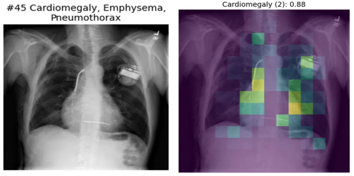 Left: Original image. Right: Classifier prediction and attention visualization.
