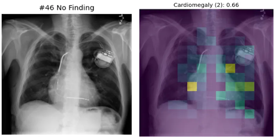 Left: Original image. Right: Classifier prediction and attention visualization.